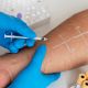 Prolotherapy and Peri-Neural Injections